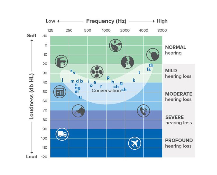 Hearing loss audiogram chart displaying sound frequency (Hz) and loudness levels (dB HL) with ranges for normal hearing, mild, moderate, severe, and profound hearing loss, including examples of sounds at each level.