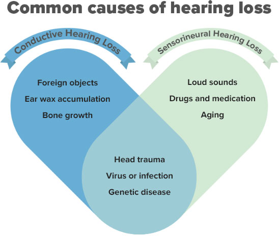 Heart-shaped diagram illustrating common causes of hearing loss, divided into conductive hearing loss (foreign objects, ear wax accumulation, bone growth) and sensorineural hearing loss (loud sounds, drugs and medication, aging), with overlapping causes including head trauma, virus or infection, and genetic disease.
